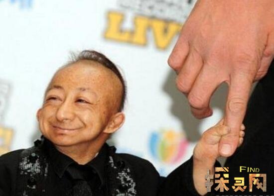 中国最矮的男人何平平，参演节目却意外死亡（身高仅为74.6cm）