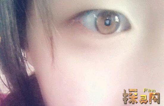 世界上最稀有瞳孔，紫罗兰眼睛最美丽/红色眼睛最吓人